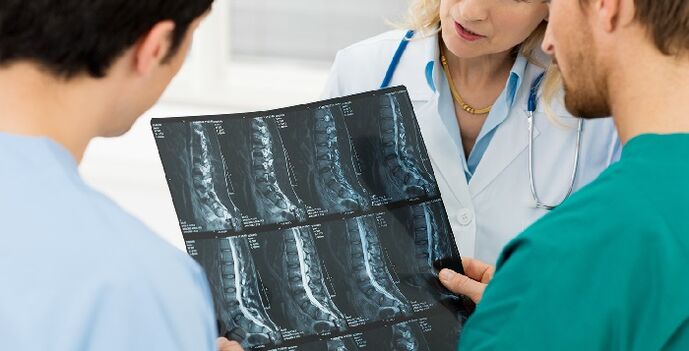 Mugurkaula rentgenogrāfija kā veids osteohondrozes diagnosticēšanai